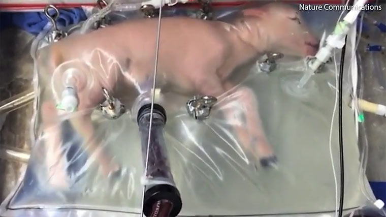 Dieser Plastikbeutel simuliert die Gebärmutter für Frühchen